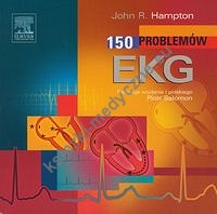 150 problemów EKG
