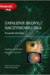 Zapalenie błony naczyniowej oka