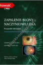 Zapalenie błony naczyniowej oka