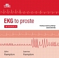EKG to proste