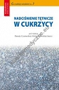Nadciśnienie tętnicze w cukrzycy 