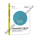 Cesarskie cięcie i poród po cięciu cesarskim