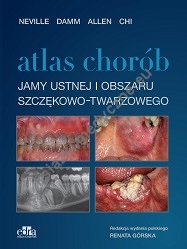 Atlas chorób jamy ustnej i obszaru szczękowo-twarzowego