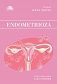 Endometrioza 
