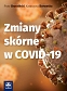 Zmiany skórne w COVID-19