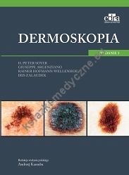 Dermoskopia