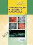 Terapia laserowa w retinopatii cukrzycowej 