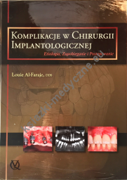 Komplikacje w chirurgii implantologicznej